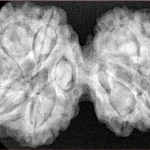 10 Mk Gaurishankar 39.9mm 8.83gm - Xray