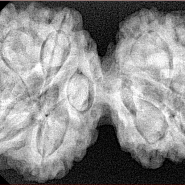 10 Mk Gaurishankar 39.9mm 8.83gm - Xray