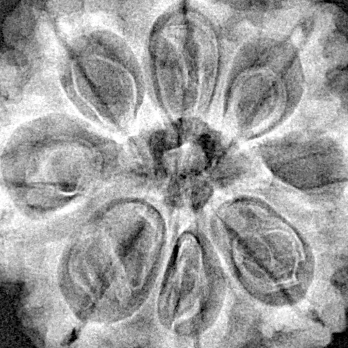 8 Mukhi Rudraksha 30.7mm 7.37gm - Xray