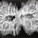 13 MK Gaurishankar 39.3mm 8.26gm - Xray