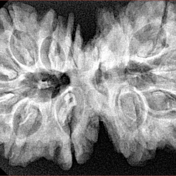 13 MK Gaurishankar 39.3mm 8.26gm - Xray