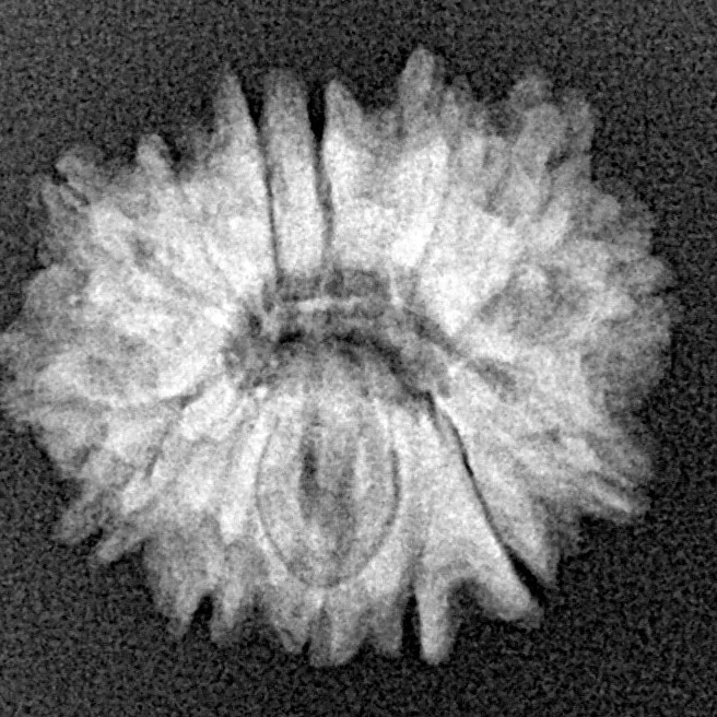 14 Mukhi Rudraksha 20.3mm 2.3gm - Xray