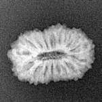 17 Mukhi Rudraksha 18.5mm 1.48gm - Xray