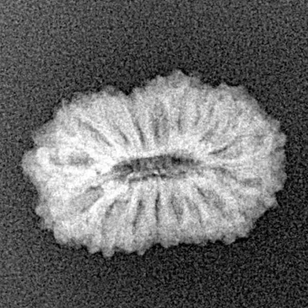 17 Mukhi Rudraksha 18.5mm 1.48gm - Xray