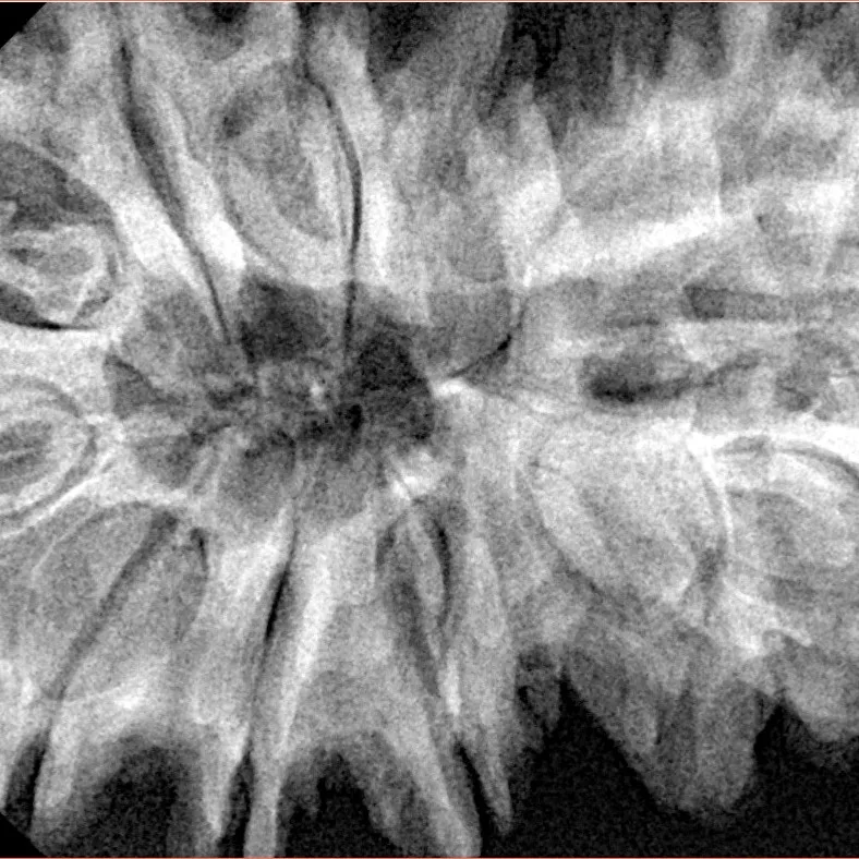 13 MK Gaurishankar 41mm 9.99gm - Xray
