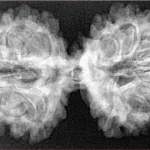 13 MK Gaurishankar 39.2mm 6.5gm - Xray