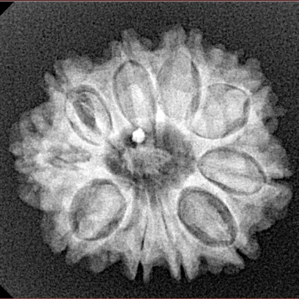 10 Mukhi Rudraksha 23.3mm 3.85gm - Xray