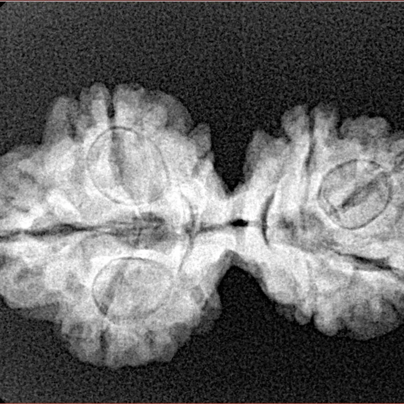 7 MK Gaurishankar 28.8mm 3.79gm - Xray