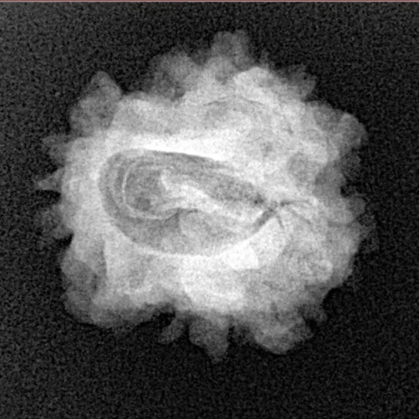 1 Mukhi Rudraksha 23.1mm 2.93gm - Xray