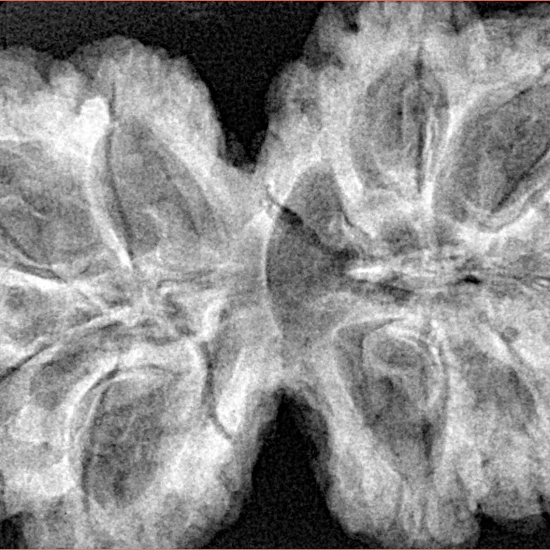 10 Mk Gaurishankar 38.3mm 8.2gm - Xray