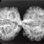 10 Mukhi G.S & Ganesh 35.3mm 5.61gm - Xray