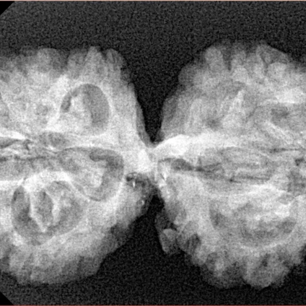 10 Mukhi G.S & Ganesh 35.3mm 5.61gm - Xray