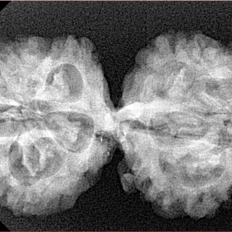 10 Mukhi G.S & Ganesh 35.3mm 5.61gm - Xray
