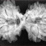 11 MK Gaurishankar 36.5mm 7.37gm - Xray