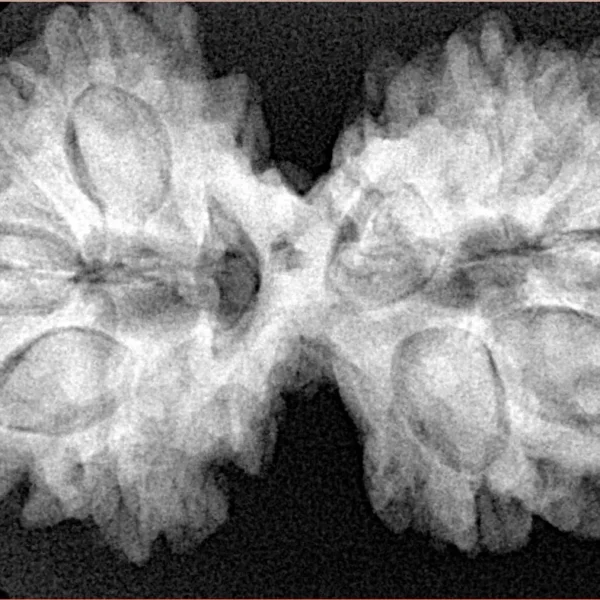 11 MK Gaurishankar 36.5mm 7.37gm - Xray