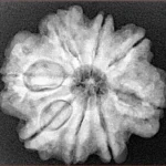 8 Mukhi Rudraksha 25.8mm 5.36gm - Xray