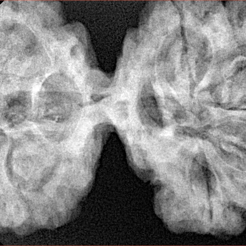 8 MK Gaurishankar 43.2mm 11.53gm - Xray