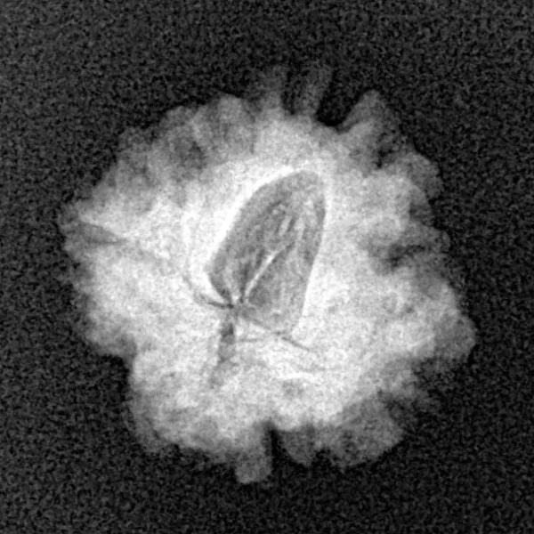 1 Mukhi Rudraksha 18.3mm 1.74gm - Xray