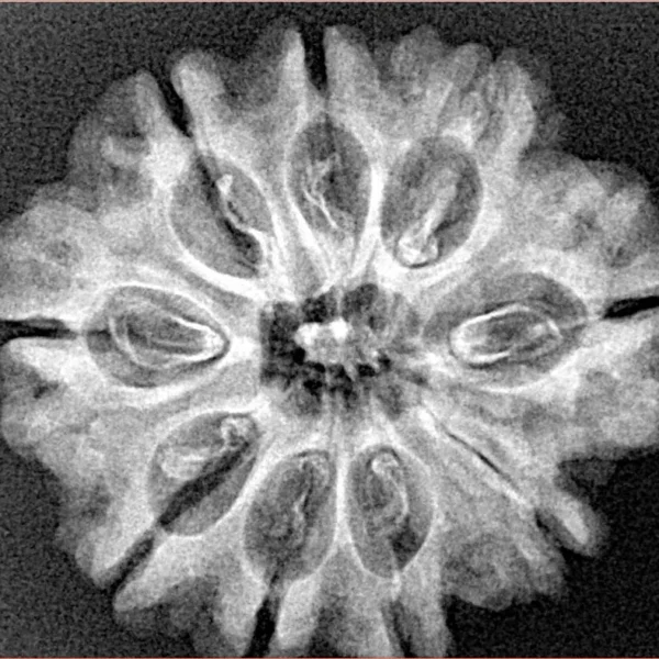 9 Mukhi Rudraksha 26.8mm 3.9gm - Xray