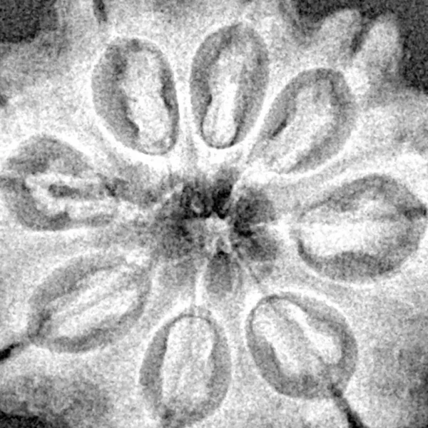 8 Mukhi Rudraksha 27.2mm 5.28gm - Xray