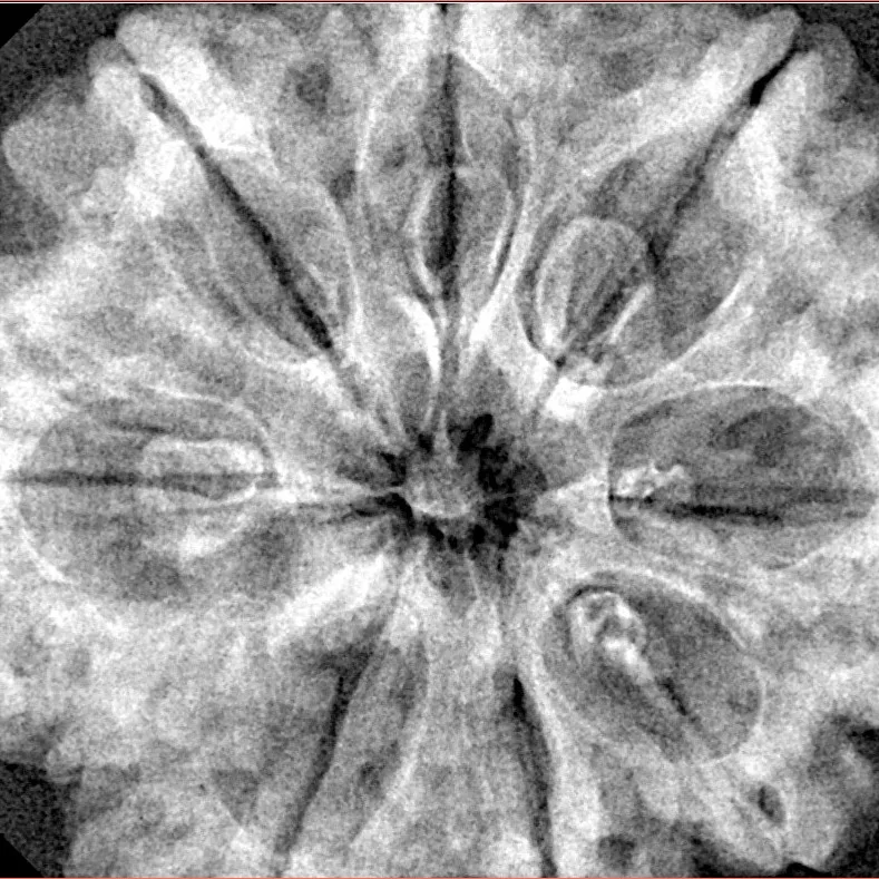 8 Mukhi Rudraksha 33mm 8gm - Xray