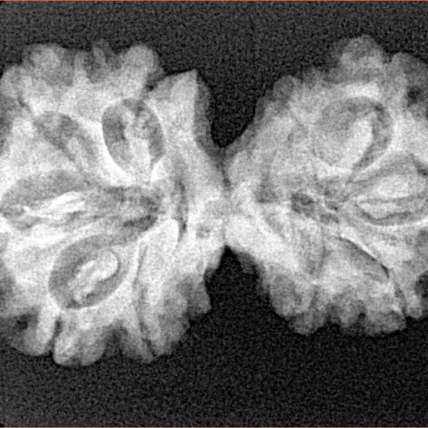 10 Mukhi G.S & Ganesh 31.8mm 4.47gm - Xray