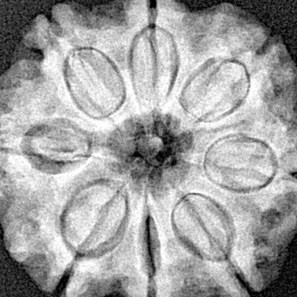 8 Mukhi Rudraksha 24.3mm 5.04gm - Xray