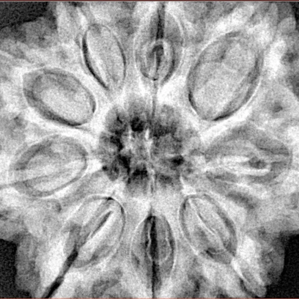 9 Mukhi Rudraksha 32mm 9.35gm - Xray