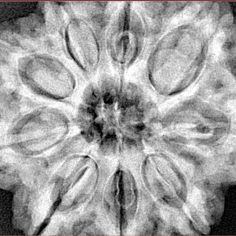9 Mukhi Rudraksha 32mm 9.35gm - Xray