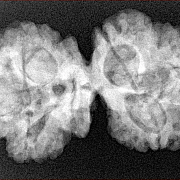 6 Mk Gaurishankar 35.5mm 6.41gm - Xray