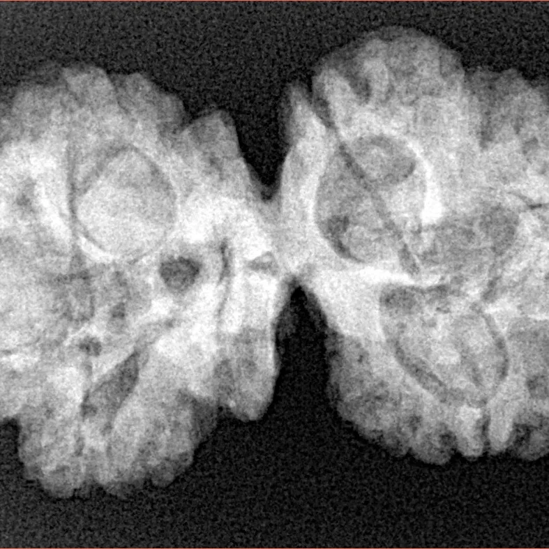 6 Mk Gaurishankar 35.5mm 6.41gm - Xray