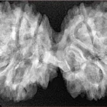 11 MK Gaurishankar 41.4mm 8.17gm - Xray