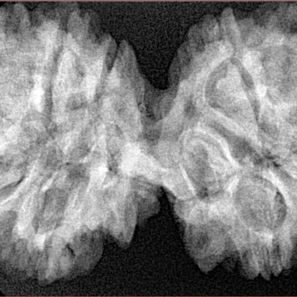 11 MK Gaurishankar 41.4mm 8.17gm - Xray