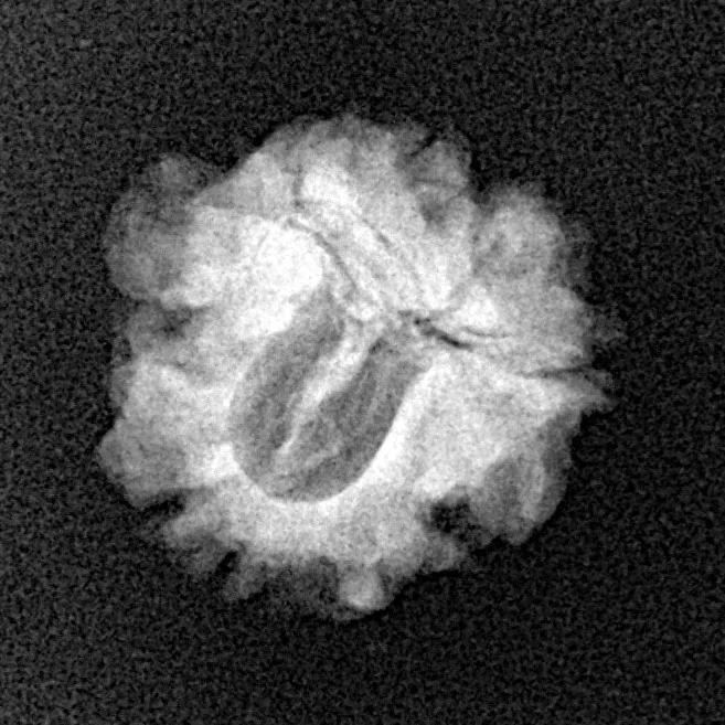 1 Mukhi Rudraksha 19.2mm 1.86gm - Xray