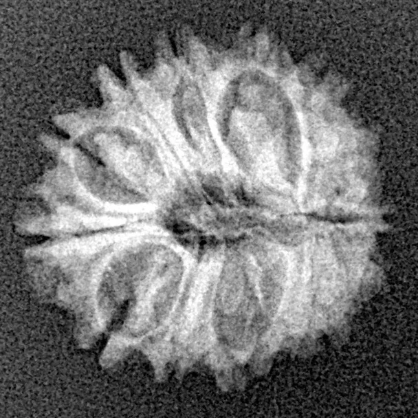 14 Mukhi Rudraksha 17.7mm 1.51gm - Xray