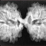 11 MK Gaurishankar 37.8mm 7gm - Xray