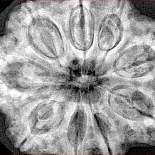 9 Mukhi Rudraksha 32.4mm 8.44gm - Xray