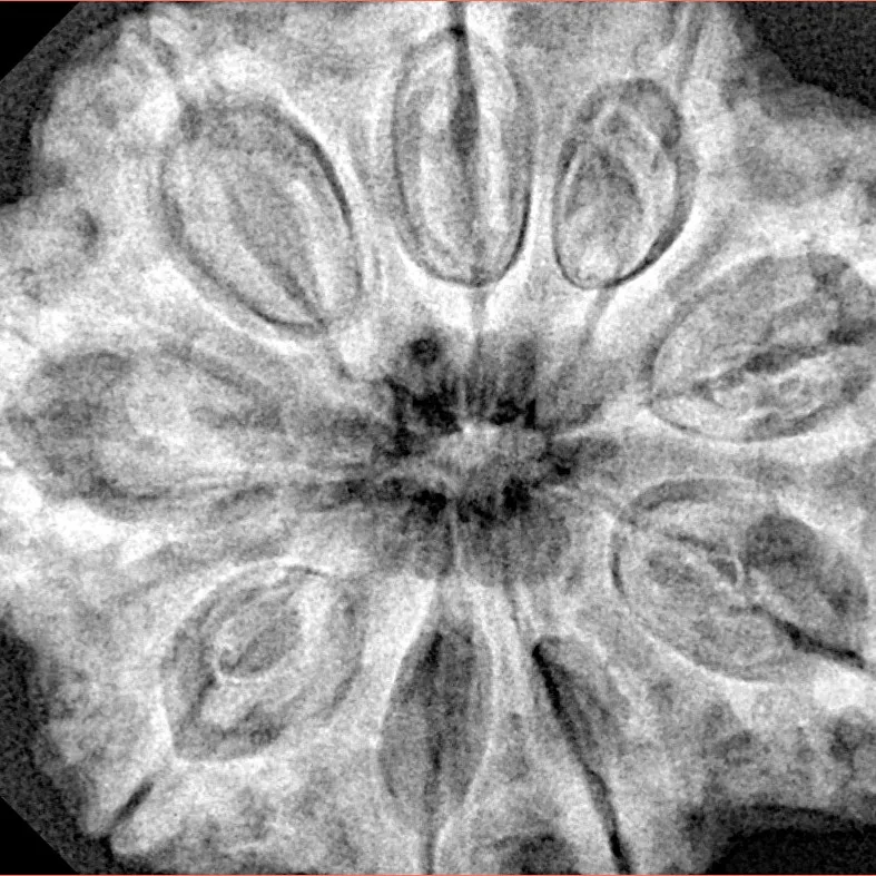 9 Mukhi Rudraksha 32.4mm 8.44gm - Xray