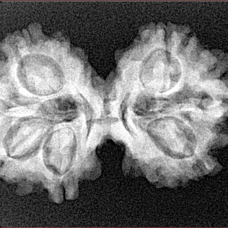 7 MK Gaurishankar 30.8mm 4.28gm - Xray