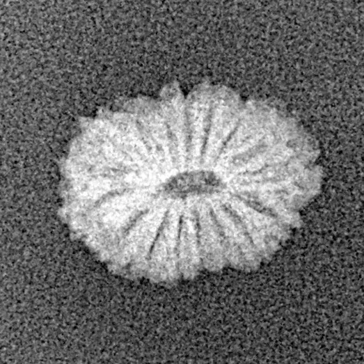 17 Mukhi Rudraksha 12.6mm 0.46gm - Xray