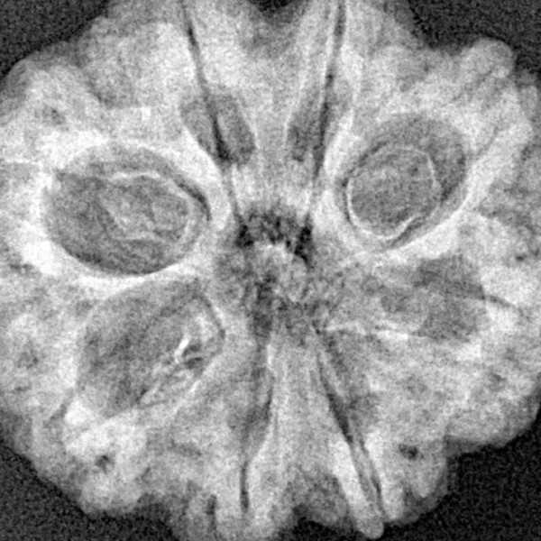8 Mukhi Rudraksha 27.6mm 4.88gm - Xray