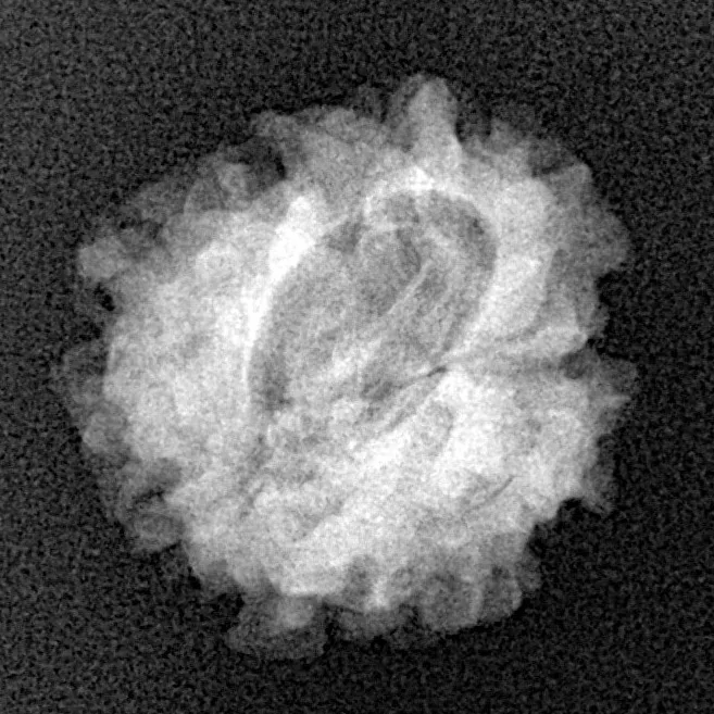 1 Mukhi Rudraksha 19.7mm 2.27gm - Xray