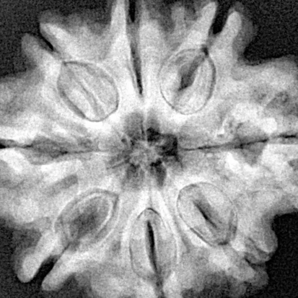 8 Mukhi Rudraksha 28.3mm 6.37gm - Xray
