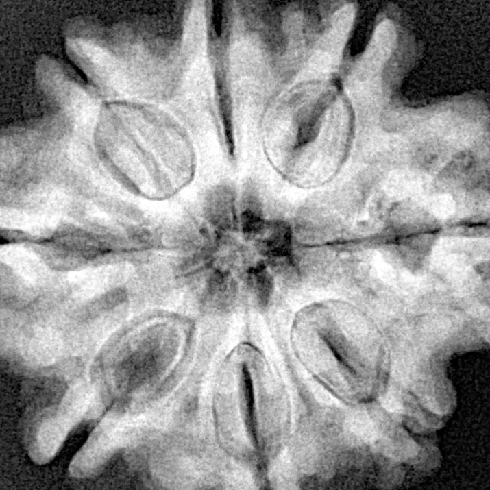 8 Mukhi Rudraksha 28.3mm 6.37gm - Xray