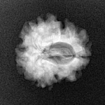 1 Mukhi Rudraksha 21mm 2.19gm - Xray