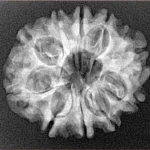 10 Mukhi Rudraksha 24.8mm 3.38gm - Xray