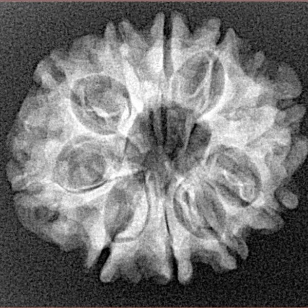 10 Mukhi Rudraksha 24.8mm 3.38gm - Xray