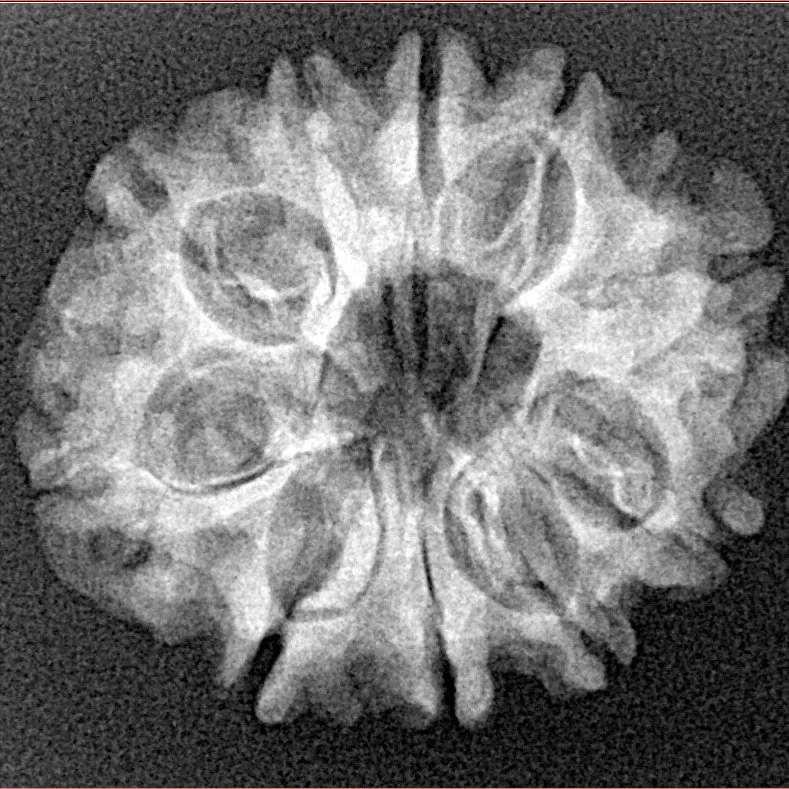 10 Mukhi Rudraksha 24.8mm 3.38gm - Xray