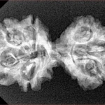 7 MK Gaurishankar 33mm 3.54gm - Xray
