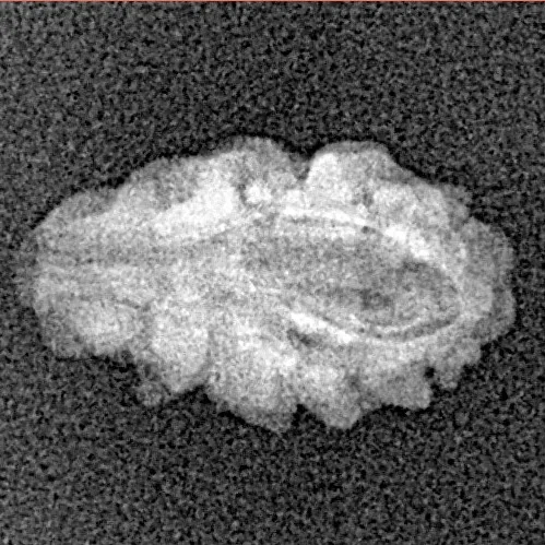 1 Mukhi Rudraksha 15mm 0.52gm - Xray
